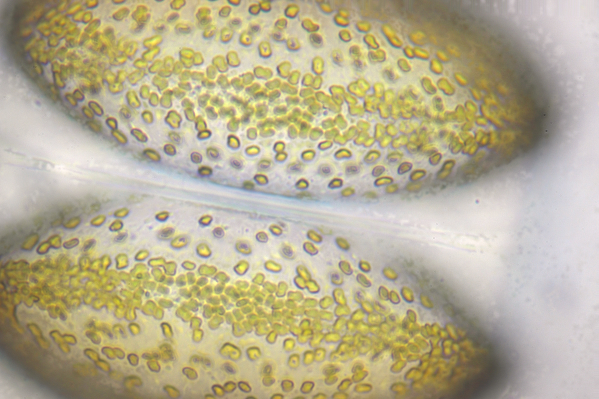 plankton Oostende_Coscinodiscus (cf) 600x